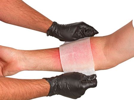 BurnTec Burn Dressing