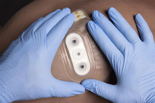 Bolin Chest Seal