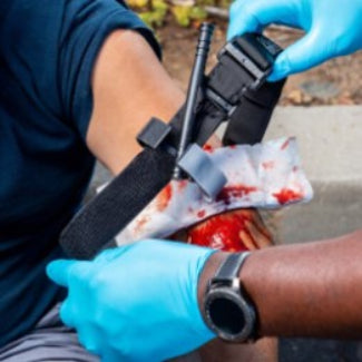 Person applying a CAT tourniquet to an injured arm with medical gloves on