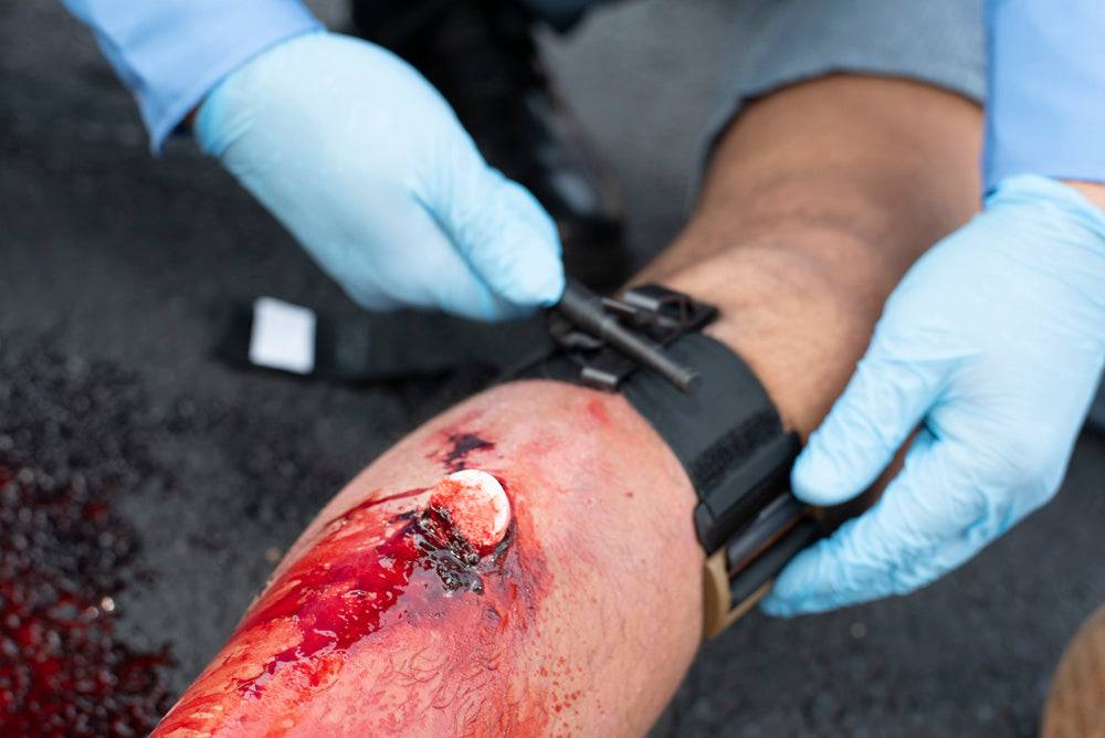 Tactical Mechanical Tourniquet (TMT)